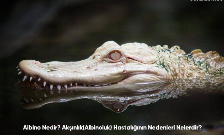 Albino Nedir AksinlikAlbinoluk Hastaliginin Nedenleri Nelerdir6