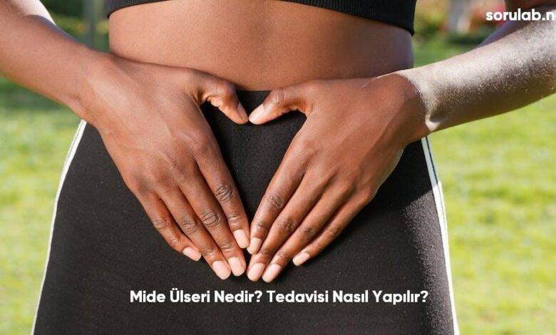 Mide Ulseri Nedir Tedavisi Nasil Yapilir6